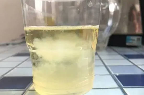孕期在尿里方盐能测出怀男女