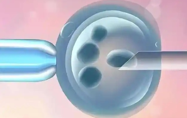 女方nk比例低对三代试管移植胚胎成功率有影响吗？