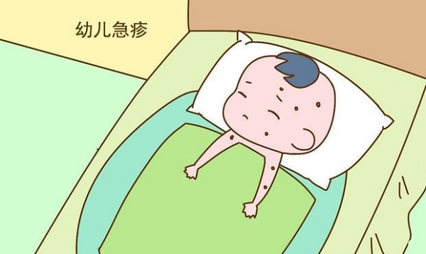 如何判断小儿急疹，可通过这八个典型特点