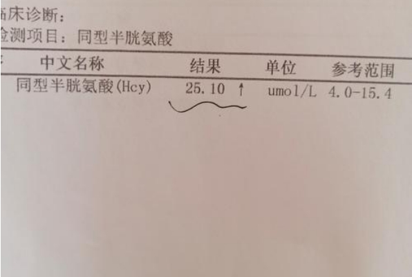 备孕检查hcy是有什么用，可以预防复发性流产发生