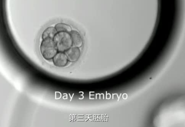 胚胎移植费用不是很高