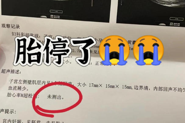 胎停备孕要做染色体检查
