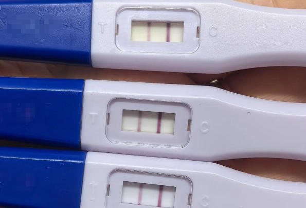 验孕棒颜色变深可能是hcg浓度增加
