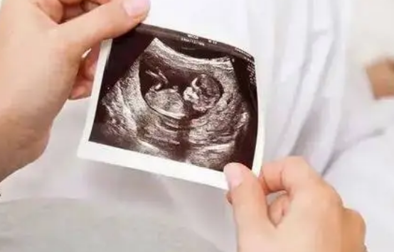 试管移植4Ab级别囊胚成功后八周胎停的几率大吗？