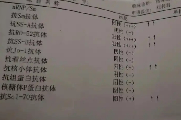 抗pm-scl抗体弱阳性备孕，药物治疗可缓解