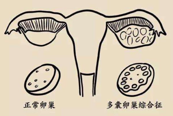 试管移植前三项激素的血值标准对照表是怎么样的？