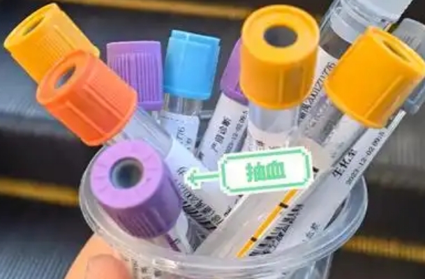 血型抗体筛查可以排查胎儿溶血