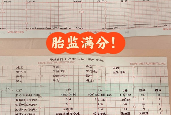 胎心监护