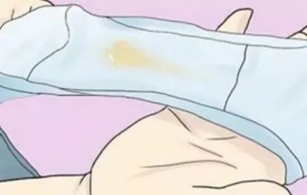 孕晚期用手从下面抠出一大坨豆腐渣是有炎症了吗？