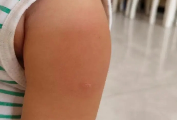 麻腮风疫苗可预防多种疾病
