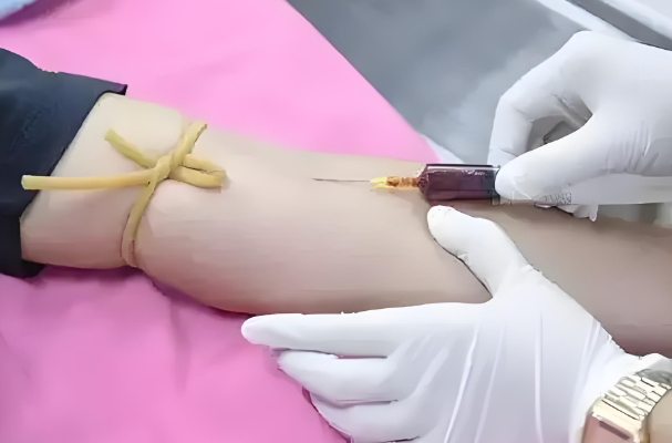 女性做三代试管期间需要连续查血值吗？