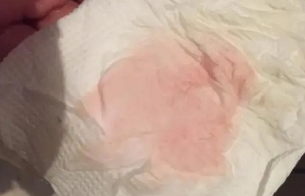 女性出现淡粉色血迹可能是成功着床了吗?