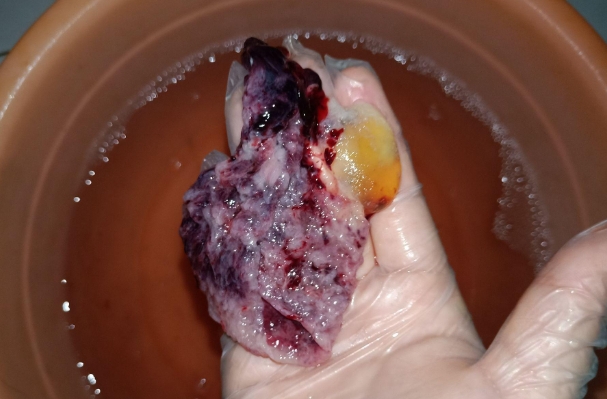 孕囊冲水后还是原来的形状