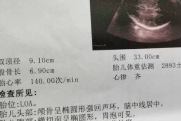 孕中期四维彩超后，宝宝还会出现兔唇