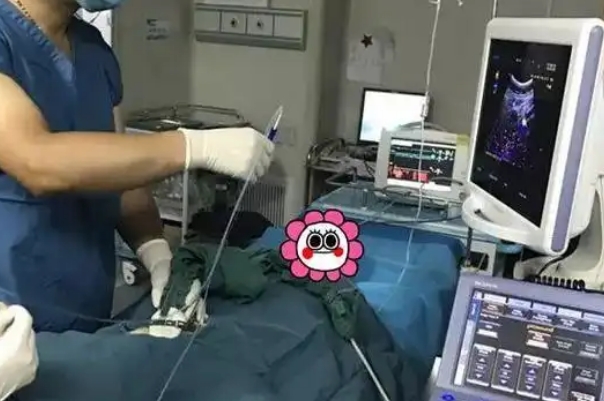 取卵后身体会感到不适