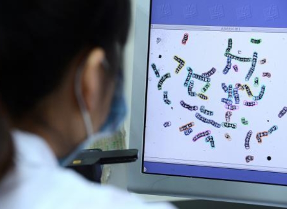 男方需要做染色体检查