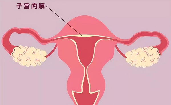 薄型子宫内膜做试管移植用哪种促排方案比较好?