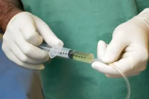 羊水穿刺是产前的一种诊断方式