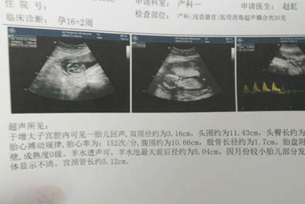 孕期四维彩超三大方面看男女，家长看完都会分辨