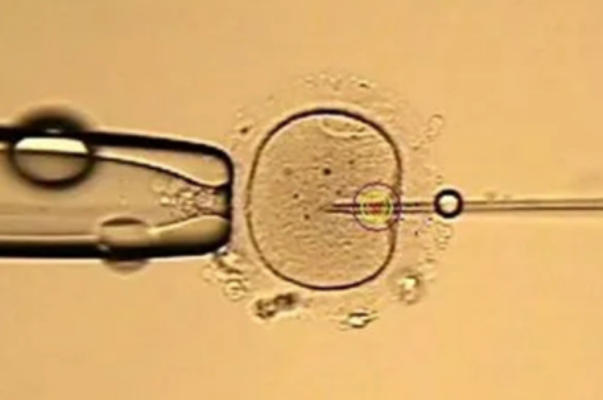 不孕家庭可以去爱丁宝做试管