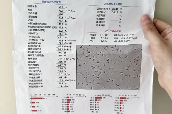 男性备孕必看，这7项检查项目别偷懒科学当爸从这一步开始