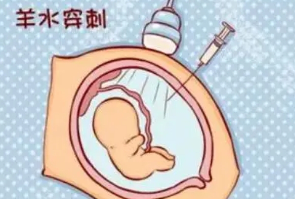 盘点看男丁女娃最准的方法，羊膜穿刺准确率可达99%