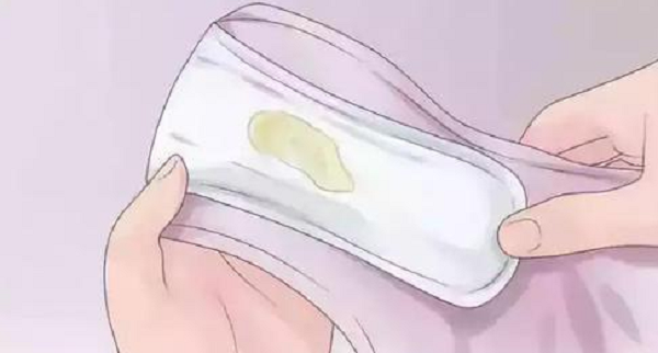 白带增多像鸡蛋清一样是不是说明怀孕了?