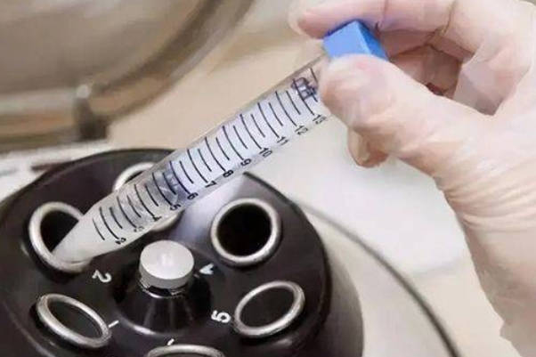 备孕男性精子畸形率高会影响受孕率，按这样调理方可改善！