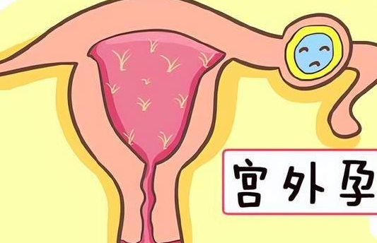 试管移植后是可能发生宫外孕