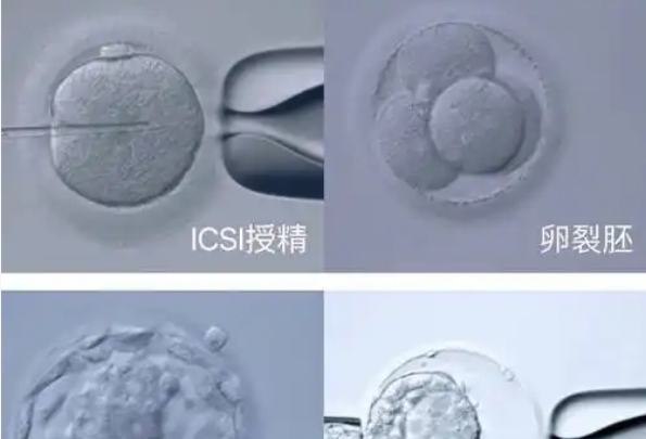试管婴儿技术大揭秘，第一代VS第二代本质区别在哪