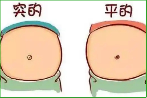 肚脐内凹就是男孩
