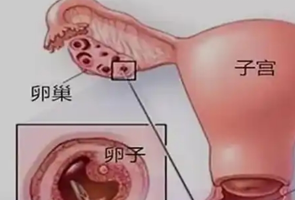 试管婴儿促排卵全过程，从药物调理到针刺取出卵泡