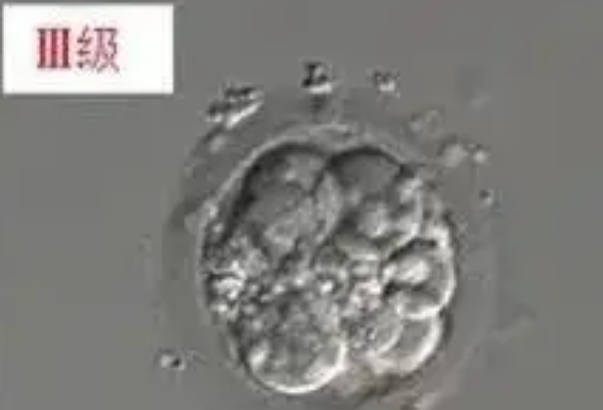 7细胞三级胚胎质量比较差