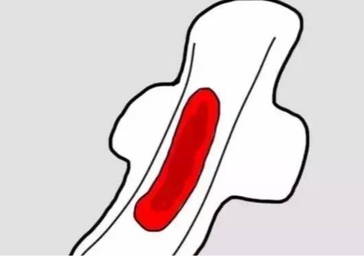 女方做孕前检查需避开月经期
