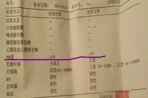 根据女性妇科ph值对照表来看多少算正常?