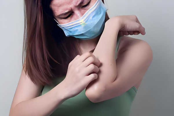 湿疹会导致身体发痒