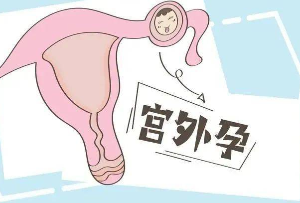 宫外孕胚胎着床在输卵管