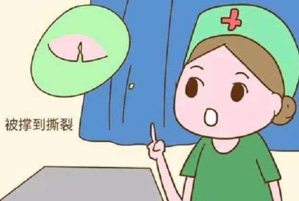 会阴撕裂其实很常见