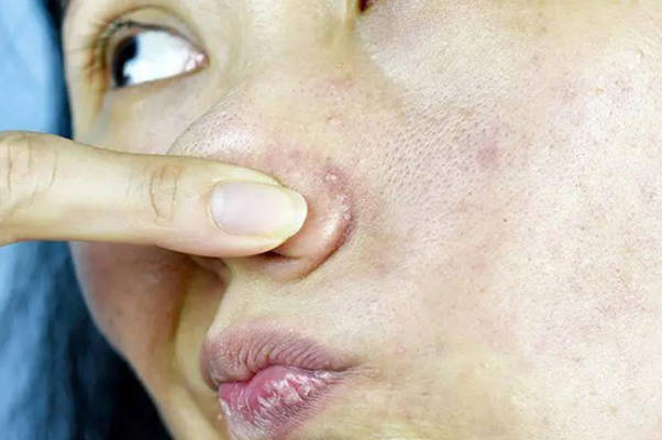 孕期1-3月手麻与胎儿性别无直接关联，揭秘怀男孩的真实信号与误区