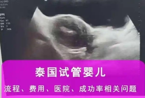 泰国试管婴儿费用