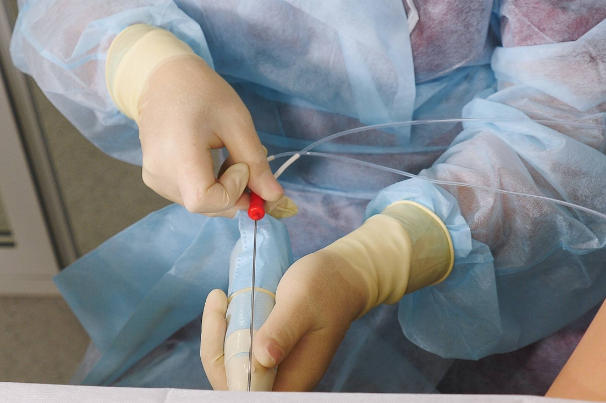 胚胎的质量会影响试管的成功率