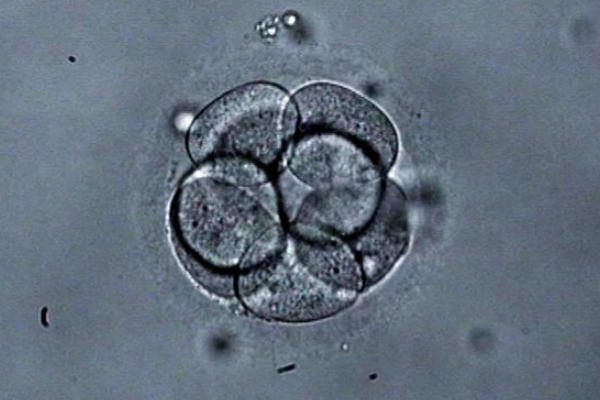 试管婴儿移植期间可以多放几个胚胎提高成功率吗？