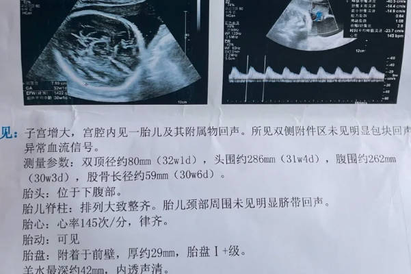胎儿偏小一周是很正常的情况