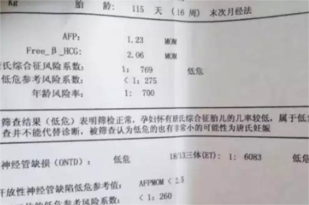 唐筛报告单主要看风险比值