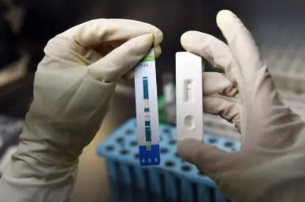 试管婴儿治疗前需要进行HIV检查