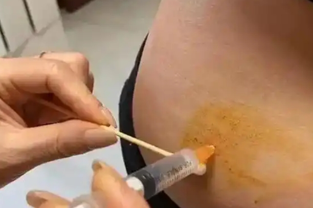 一般情况促排卵期间卵泡不会提前排掉