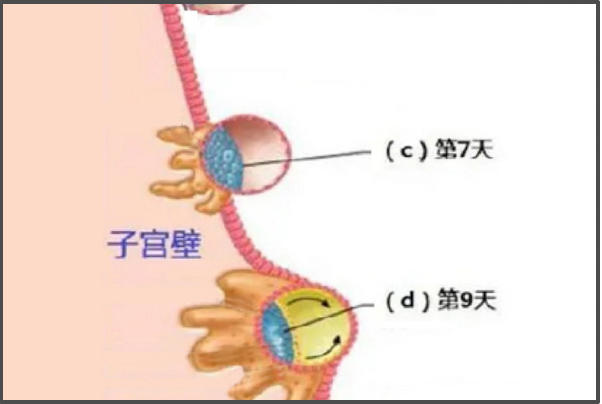 内膜的厚度会影响移植着床的时间