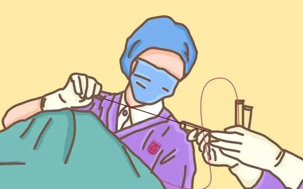 手术穿刺引流可以促使腹水排出