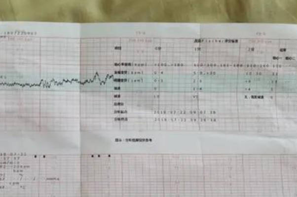 胎心监护曲线图主要是看胎心率