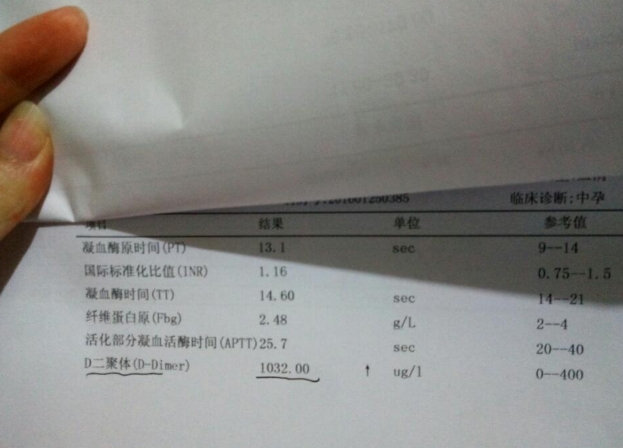 d2聚体过高会导致胚胎停育